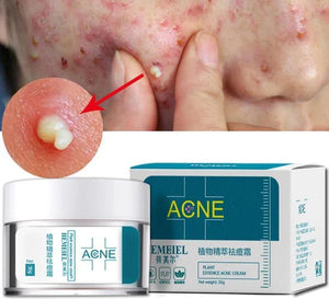 "Natural Acne Fighter – HEMEIEL Herbal Acne Cream"