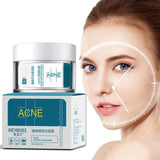"Natural Acne Fighter – HEMEIEL Herbal Acne Cream"